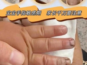 宝宝才三根手指就受不了？如何应对宝宝的不适？