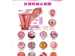 女性24种B型外形图片【有哪些展示女性 24 种 B 型外形的图片？】