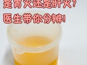 为什么会有人被胶水堵住不让尿？遇到这种情况该怎么办？