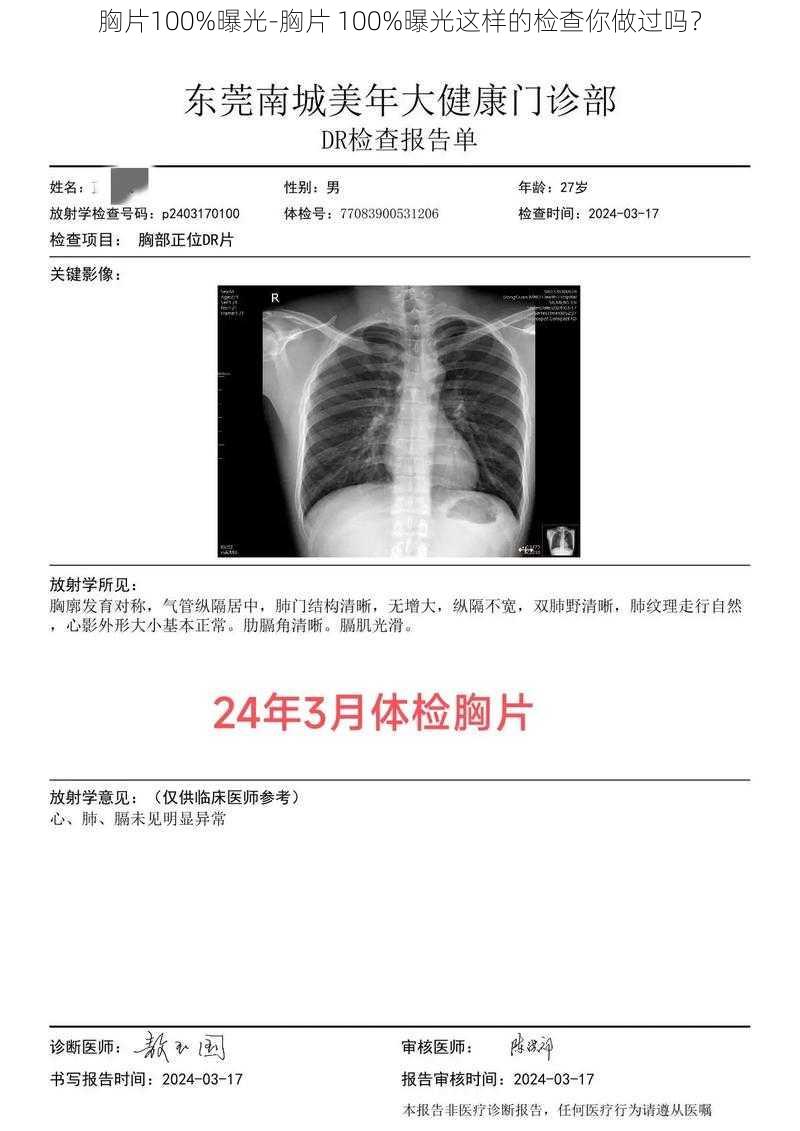 胸片100%曝光-胸片 100%曝光这样的检查你做过吗？