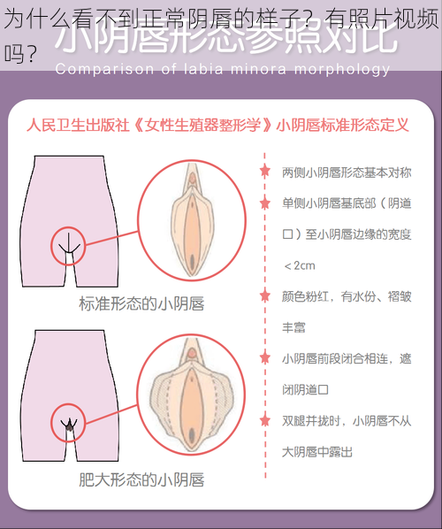 为什么看不到正常阴脣的样子？有照片视频吗？